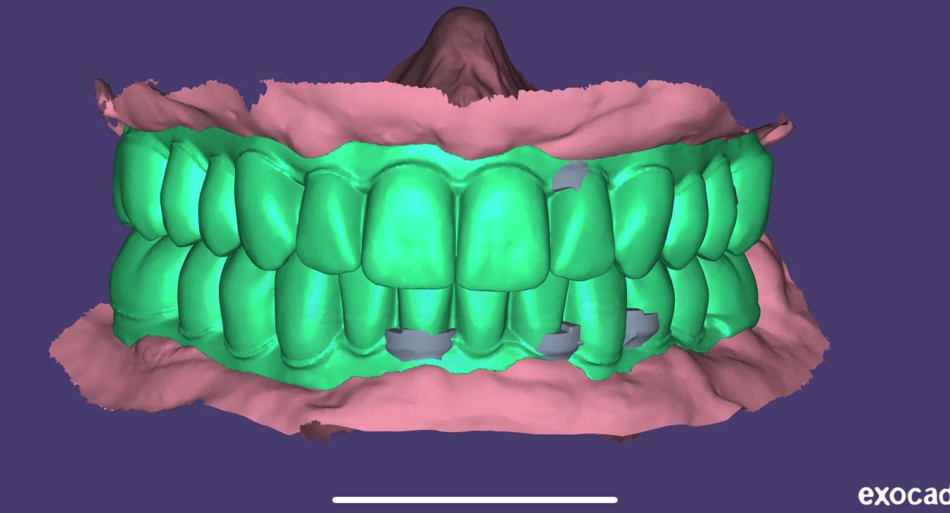 Tecnologie digitali per dentisti