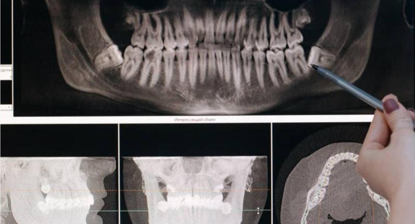 Tecnologie digitali per dentisti